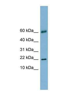 Western Blot: Galectin-14/LGALS14 Antibody [NBP1-57683] - Human Stomach, concentration 0.2-1 ug/ml.