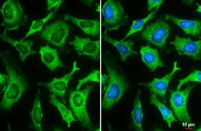 <b>Genetic Strategies Validation. </b>Immunocytochemistry/Immunofluorescence: Galectin-3 Antibody (GT12712) [NBP3-13641] - Galectin-3 antibody [GT12712] detects Galectin-3 protein at cytoplasm by immunofluorescent analysis. Sample: HeLa cells were fixed in ice-cold MeOH for 5 min. Green: Galectin-3 stained by Galectin-3 antibody [GT12712] (NBP3-13641) diluted at 1:200. Blue: Hoechst 33342 staining. Scale bar= 10 um.