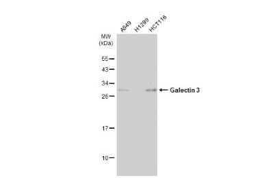 Western Blot: Galectin-3 Antibody (GT12712) [NBP3-13641] - Various whole cell extracts (30 ug) were separated by 12% SDS-PAGE, and the membrane was blotted with Galectin-3 antibody [GT12712] (NBP3-13641) diluted at 1:500. The HRP-conjugated anti-mouse IgG antibody (NBP2-19382) was used to detect the primary antibody.