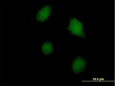 Immunocytochemistry/Immunofluorescence: Galectin-3 Antibody [H00003958-B01P] - Analysis of purified antibody to LGALS3 on HeLa cell. (antibody concentration 10 ug/ml)