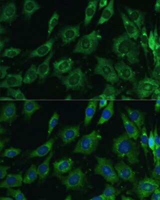 Immunocytochemistry/Immunofluorescence: Galectin-3 Antibody [NBP3-03252] - Analysis of C6 cells using Galectin-3 antibody at dilution of 1:100. Blue: DAPI for nuclear staining.