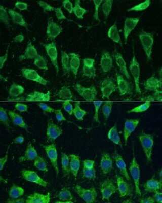 Immunocytochemistry/Immunofluorescence: Galectin-3 Antibody [NBP3-03252] - Analysis of L-929 cells using Galectin-3 antibody at dilution of 1:100. Blue: DAPI for nuclear staining.