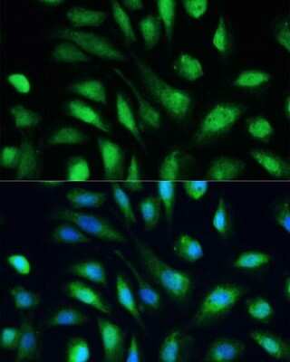 Immunocytochemistry/Immunofluorescence: Galectin-3 Antibody [NBP3-03252] - Analysis of U-2 OS cells using Galectin-3 antibody at dilution of 1:100. Blue: DAPI for nuclear staining.