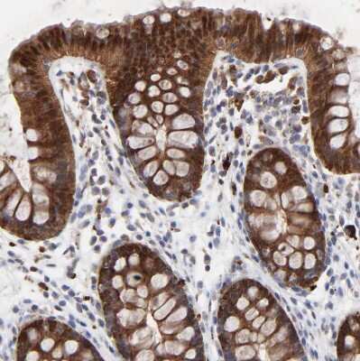 Immunohistochemistry-Paraffin: Galectin-3 Antibody [NBP1-89795] - Staining of human colon shows strong cytoplasmic and nuclear positivity in glandular cells.