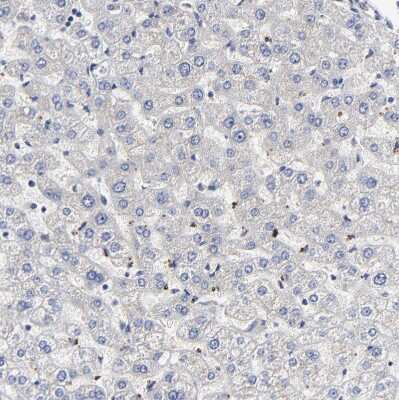 Immunohistochemistry-Paraffin: Galectin-3 Antibody [NBP1-89795] - Staining of human liver shows no positivity in hepatocytes as expected.
