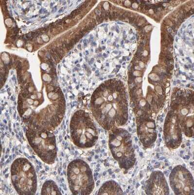 Immunohistochemistry-Paraffin: Galectin-3 Antibody [NBP1-89795] - Staining of human small intestine shows strong cytoplasmic positivity in glandular cells.