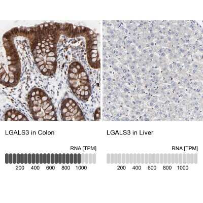 Immunohistochemistry-Paraffin: Galectin-3 Antibody [NBP1-89795] - Staining in human colon and liver tissues using NBP1-89795 antibody. Corresponding LGALS3 RNA-seq data are presented for the same tissues.