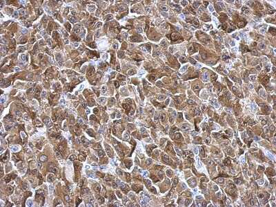 Immunohistochemistry-Paraffin: Galectin-3 Antibody [NBP2-16589] - HBL435 xenograft, using Galectin3 antibody at 1:500 dilution. Antigen Retrieval: Trilogy™ (EDTA based, pH 8.0) buffer, 15min.