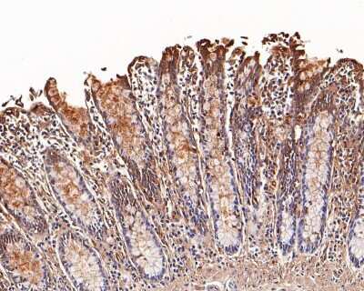 Immunohistochemistry-Paraffin: Galectin-3 Antibody (JF39-10) [NBP2-66857] - Analysis of paraffin-embedded human colon tissue with Rabbit anti-Galectin 3 (1/1,000) antibody. The section was pre-treated using heat mediated antigen retrieval with sodium citrate buffer (pH 6.0) for 2 minutes. The tissues were blocked in 1% BSA for 20 minutes at room temperature, washed with ddH2O and PBS, and then probed with the primary antibody for 1 hour at room temperature. The detection was performed using an HRP conjugated compact polymer system. DAB was used as the chromogen. Tissues were counterstained with hematoxylin and mounted with DPX.