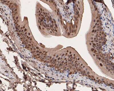Immunohistochemistry-Paraffin: Galectin-3 Antibody (JF39-10) [NBP2-66857] - Analysis of paraffin-embedded rat bladder tissue with Rabbit anti-Galectin 3 antibody washed with ddH2O and PBS, and then probed with the primary antibody  at 1/200 dilution for 1 hour at room temperature. The detection was performed using an HRP conjugated compact polymer system. DAB was used as the chromogen. Tissues were counterstained with hematoxylin and mounted with DPX.