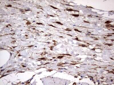 Immunohistochemistry: Galectin-3 Antibody (OTI1C7) - Azide and BSA Free [NBP2-71124] - Analysis of Human bladder tissue. (Heat-induced epitope retrieval by 1 mM EDTA in 10mM Tris, pH8.5, 120C for 3min)