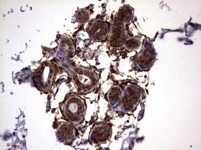 Immunohistochemistry: Galectin-3 Antibody (OTI1C7) - Azide and BSA Free [NBP2-71124] - Analysis of Human breast tissue. (Heat-induced epitope retrieval by 1 mM EDTA in 10mM Tris, pH8.5, 120C for 3min)