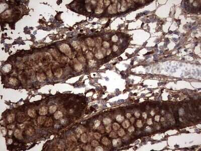 Immunohistochemistry: Galectin-3 Antibody (OTI1C7) - Azide and BSA Free [NBP2-71124] - Analysis of Human colon tissue. (Heat-induced epitope retrieval by 1 mM EDTA in 10mM Tris, pH8.5, 120C for 3min)