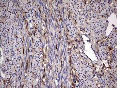 Immunohistochemistry: Galectin-3 Antibody (OTI1C7) - Azide and BSA Free [NBP2-71124] - Analysis of Human endometrium tissue. (Heat-induced epitope retrieval by 1 mM EDTA in 10mM Tris, pH8.5, 120C for 3min)