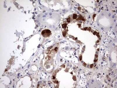 Immunohistochemistry: Galectin-3 Antibody (OTI1C7) - Azide and BSA Free [NBP2-71124] - Analysis of Human Kidney tissue. (Heat-induced epitope retrieval by 1 mM EDTA in 10mM Tris, pH8.5, 120C for 3min)