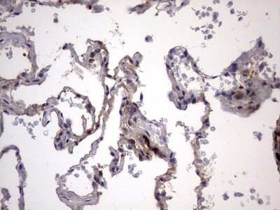 Immunohistochemistry: Galectin-3 Antibody (OTI1C7) - Azide and BSA Free [NBP2-71124] - Analysis of Human lung tissue. (Heat-induced epitope retrieval by 1 mM EDTA in 10mM Tris, pH8.5, 120C for 3min)