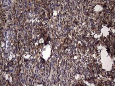 Immunohistochemistry: Galectin-3 Antibody (OTI1C7) - Azide and BSA Free [NBP2-71124] - Analysis of Human Ovary tissue. (Heat-induced epitope retrieval by 1 mM EDTA in 10mM Tris, pH8.5, 120C for 3min)
