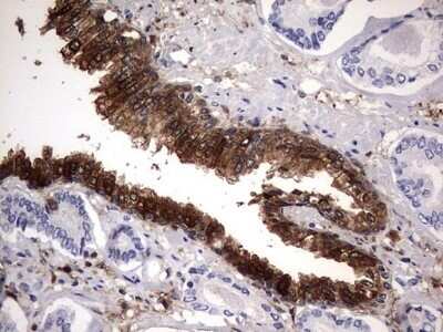 Immunohistochemistry: Galectin-3 Antibody (OTI1C7) - Azide and BSA Free [NBP2-71124] - Analysis of Human prostate tissue. (Heat-induced epitope retrieval by 1 mM EDTA in 10mM Tris, pH8.5, 120C for 3min)