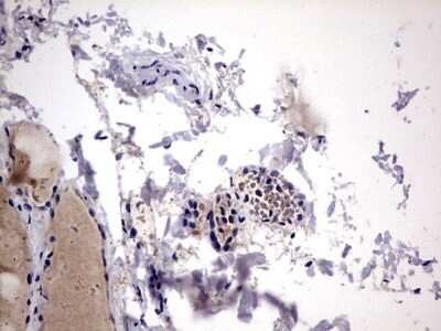 Immunohistochemistry: Galectin-3 Antibody (OTI1C7) - Azide and BSA Free [NBP2-71124] - Analysis of Human thyroid tissue. (Heat-induced epitope retrieval by 1 mM EDTA in 10mM Tris, pH8.5, 120C for 3min)