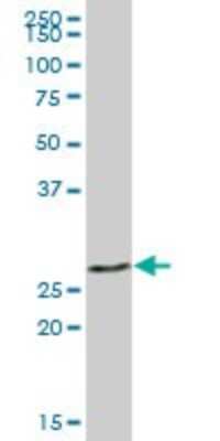 Western Blot: Galectin-3 Antibody [H00003958-B01P] - Analysis of LGALS3 expression in human spleen.