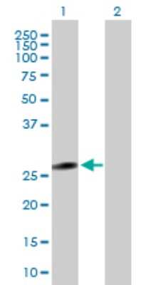 Western Blot: Galectin-3 Antibody [H00003958-B01P] - Analysis of LGALS3 expression in transfected 293T cell line by LGALS3 polyclonal antibody.  Lane 1: LGALS3 transfected lysate(27.5 KDa). Lane 2: Non-transfected lysate.