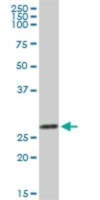 Western Blot: Galectin-3 Antibody [H00003958-D01P] - Analysis of LGALS3 expression in human colon.