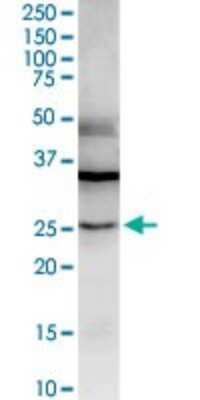 Western Blot: Galectin-3 Antibody [H00003958-D01P] - Analysis of LGALS3 expression in human stomach.