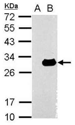 Western Blot: Galectin-3 Antibody [NBP2-16589] - Sample (30 ug of whole cell lysate) A: Non-transfected 293T lysates B: LGALS3 transfected 293T lysates 12% SDS PAGE gel, diluted at 1:10000.