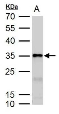 Western Blot: Galectin-3 Antibody [NBP2-16589] - Galectin-3 antibody detects Galectin-3 protein by western blot analysis. A. 50 ug rat colon lysate/extract. 12% SDS-PAGE. Galectin-3 antibody dilution: 1:10000.