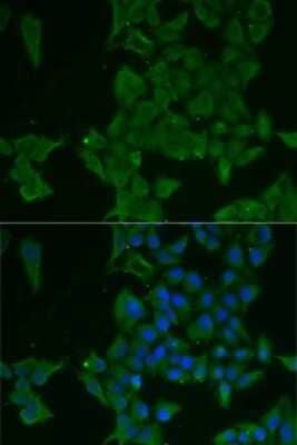 Immunocytochemistry/Immunofluorescence: Galectin-3BP/MAC-2BP/LGALS3BP Antibody [NBP3-03669] - Analysis of MCF7 cells using Galectin-3BP/MAC-2BP/LGALS3BP antibody . Blue: DAPI for nuclear staining.