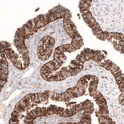 Immunohistochemistry-Paraffin: Galectin-3BP/MAC-2BP/LGALS3BP Antibody [NBP1-89346] - Staining of human fallopian tube shows strong granular cytoplasmic positivity in glandular cells.