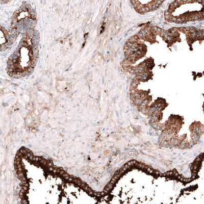 Immunohistochemistry-Paraffin: Galectin-3BP/MAC-2BP/LGALS3BP Antibody [NBP1-89346] - Staining of human prostate shows strong cytoplasmic positivity in glandular cells.