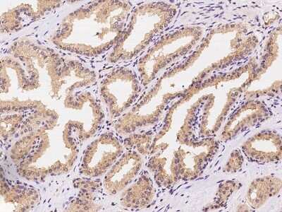 Immunohistochemistry-Paraffin: Galectin-3BP/MAC-2BP/LGALS3BP Antibody [NBP2-97200] - Immunochemical staining of human Galectin-3BP/MAC-2BP/LGALS3BP in human prostate with rabbit polyclonal antibody at 1:100 dilution, formalin-fixed paraffin embedded sections.