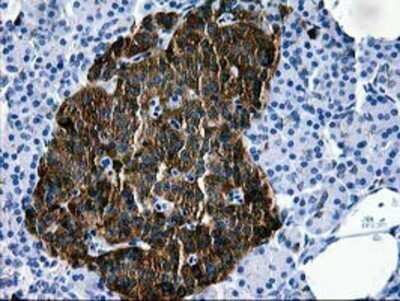 Immunohistochemistry: Galectin-3BP/MAC-2BP/LGALS3BP Antibody (OTI6B7) - Azide and BSA Free [NBP2-71125] - Staining of paraffin-embedded Human pancreas tissue using anti-LGALS3BP mouse monoclonal antibody.