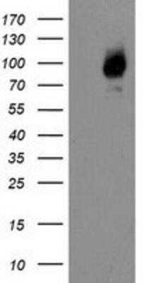 Western Blot: Galectin-3BP/MAC-2BP/LGALS3BP Antibody (OTI6B7) - Azide and BSA Free [NBP2-71125] - HEK293T cells were transfected with the pCMV6-ENTRY control (Left lane) or pCMV6-ENTRY LGALS3BP (Right lane) cDNA for 48 hrs and lysed. Equivalent amounts of cell lysates (5 ug per lane) were separated by SDS-PAGE and immunoblotted with anti-LGALS3BP.