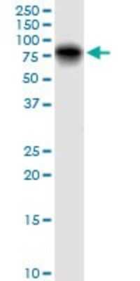 Western Blot: Galectin-3BP/MAC-2BP/LGALS3BP Antibody [H00003959-B01P] - Analysis of LGALS3BP expression in A-431.
