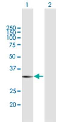 Western Blot: Galectin-8 Antibody [H00003964-B01P] - Analysis of LGALS8 expression in transfected 293T cell line by LGALS8 polyclonal antibody.  Lane 1: LGALS8 transfected lysate(34.87 KDa). Lane 2: Non-transfected lysate.