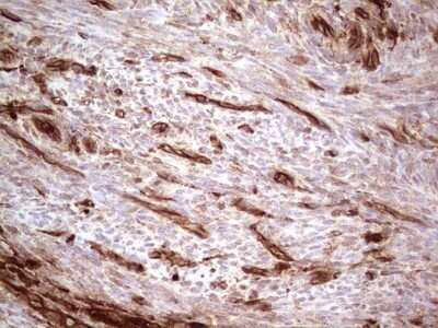 Immunohistochemistry: Galectin-9 Antibody (OTI1D12) - Azide and BSA Free [NBP2-71132] - Analysis of Human endometrium tissue. (Heat-induced epitope retrieval by 1 mM EDTA in 10mM Tris, pH8.5, 120C for 3min)