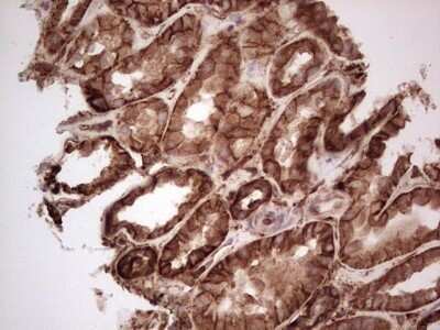 Immunohistochemistry: Galectin-9 Antibody (OTI1D12) - Azide and BSA Free [NBP2-71132] - Analysis of Human Kidney tissue. (Heat-induced epitope retrieval by 1 mM EDTA in 10mM Tris, pH8.5, 120C for 3min)