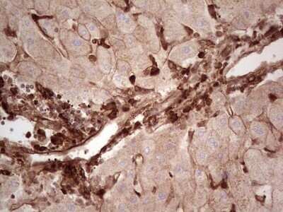 Immunohistochemistry: Galectin-9 Antibody (OTI1D12) - Azide and BSA Free [NBP2-71132] - Analysis of Human liver tissue. (Heat-induced epitope retrieval by 1 mM EDTA in 10mM Tris, pH8.5, 120C for 3min)