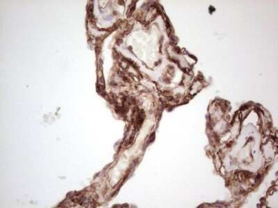 Immunohistochemistry: Galectin-9 Antibody (OTI1D12) - Azide and BSA Free [NBP2-71132] - Analysis of Human lung tissue. (Heat-induced epitope retrieval by 1 mM EDTA in 10mM Tris, pH8.5, 120C for 3min)