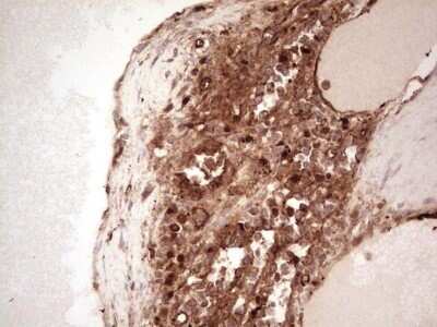 Immunohistochemistry: Galectin-9 Antibody (OTI1D12) - Azide and BSA Free [NBP2-71132] - Analysis of Human lymph node tissue. (Heat-induced epitope retrieval by 1 mM EDTA in 10mM Tris, pH8.5, 120C for 3min)