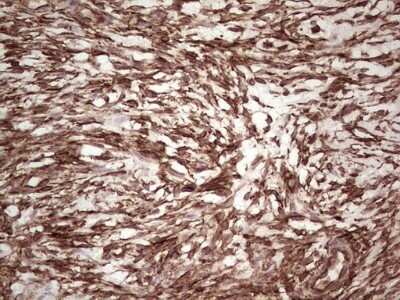 Immunohistochemistry: Galectin-9 Antibody (OTI1D12) - Azide and BSA Free [NBP2-71132] - Analysis of Human Ovary tissue. (Heat-induced epitope retrieval by 1 mM EDTA in 10mM Tris, pH8.5, 120C for 3min)