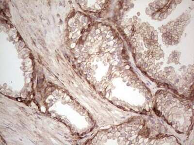 Immunohistochemistry: Galectin-9 Antibody (OTI1D12) - Azide and BSA Free [NBP2-71132] - Analysis of Human prostate tissue. (Heat-induced epitope retrieval by 1 mM EDTA in 10mM Tris, pH8.5, 120C for 3min)