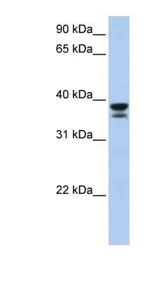 Western Blot: Galectin 9 Antibody [NBP1-58336] - Titration: 0.2-1 ug/ml, Positive Control: Human Muscle.
