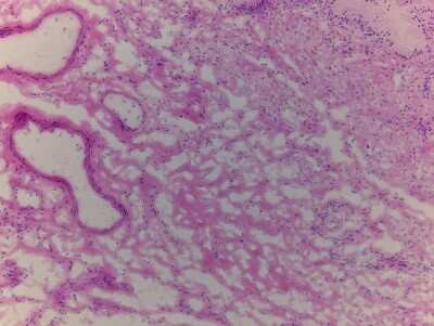 Hematoxylin & Eosin Stain: Gallbladder Tissue Slides (Adult Normal) [NBP2-77569] - Tissue: Gallbladder, Human, Normal