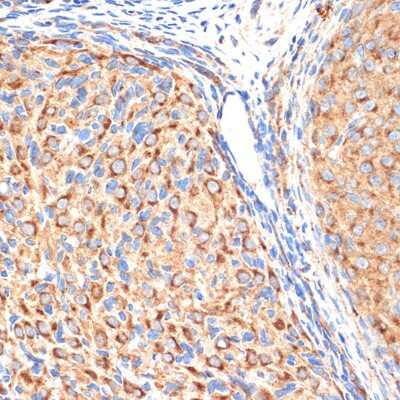 Immunohistochemistry-Paraffin Gamma Adaptin Antibody (4U2C8)