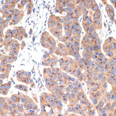 Immunohistochemistry-Paraffin Gamma Adaptin Antibody (4U2C8)