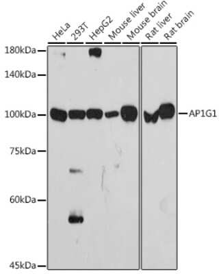 Western Blot Gamma Adaptin Antibody (4U2C8)