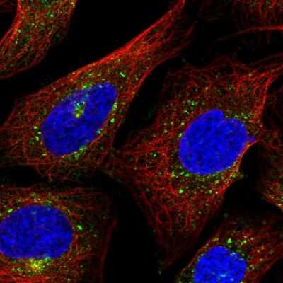 Immunocytochemistry/Immunofluorescence: Gamma Adaptin Antibody [NBP2-58947] - Staining of human cell line U-2 OS shows localization to vesicles. Antibody staining is shown in green.